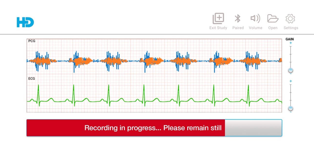 Record without moving